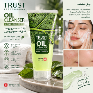 ژل شستوشوی روغنی تراست پروفشنال مدل کنترل آکنه 🌿